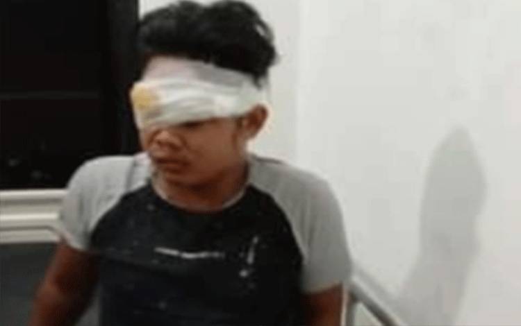 Ridho Saputra korban tabrak lari saat alami perawatan di rumah sakit dr Murjani Sampit.