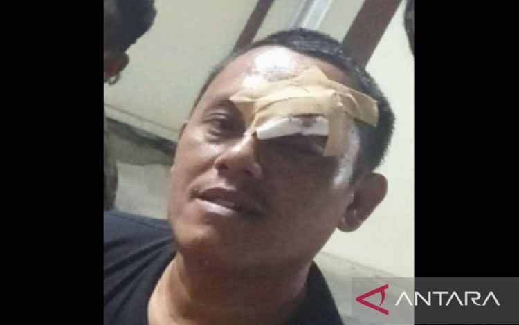 Zaenal, korban dugaan penculikan dan penganiayaan oleh oknum pejabat Pemkab Karawang. (ANTARA/Tangkap Layar WAG)