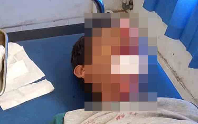 Pengendara Honda Beat nomor polisi DA 6323 KAO bernama Gusti Maksum (53) terluka parah pada bagian wajah setelah terlibat kecelakaan di Sulung Kelurahan Tamiang Layang, Senin, 5 November 2022. (FOTO: BOLE MALO)