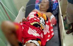 Seorang Nenek di Sampit Diserang Buaya Hingga Tangannya Putus