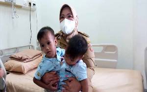 Bupati Kobar Jenguk Bayi Kembar Siam Sebelum Diberangkatkan ke Jakarta