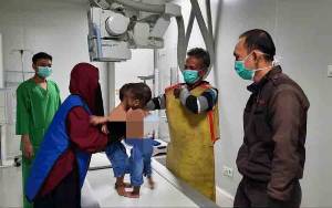 Minggu Depan Tim Dokter RSCM akan Operasi Pemisahan Balita Kembar Siam Asal Pangkalan Banteng