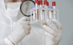 Inggris Mulai Uji Coba Tes Darah Terbesar untuk 50 Jenis Kanker