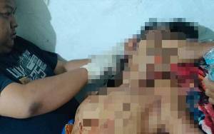 Aniaya Korban Hingga Luka-luka, Pria Ini Dilaporkan ke Polisi